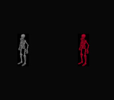 Datei:Race skeleton.jpg